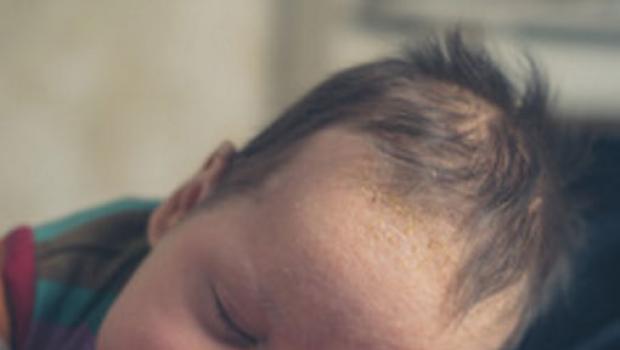 Hogyan lehet meghatározni a tejallergiát egy gyermeknél, és milyen intézkedéseket kell tenni