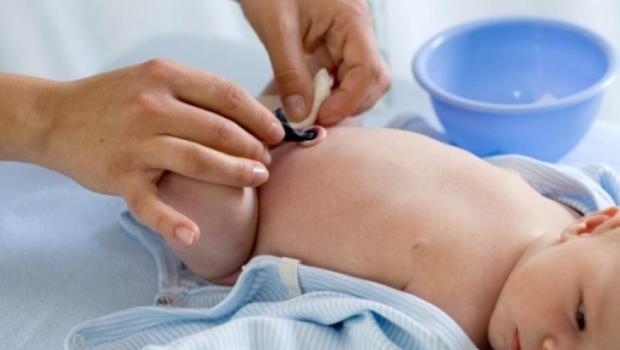 لماذا لا تشفى سرة البطن عند الأطفال حديثي الولادة؟